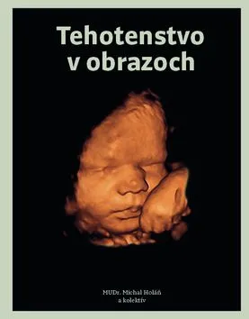 Tehotenstvo v obrazoch - MUDr. Michal Holáň